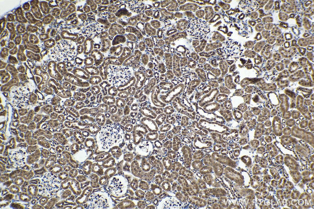 Immunohistochemical analysis of paraffin-embedded rat kidney tissue slide using KHC1515 (PKHD1 IHC Kit).