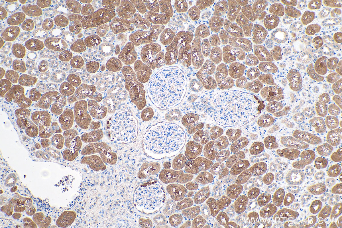 Immunohistochemical analysis of paraffin-embedded human kidney tissue slide using KHC0398 (PKLR IHC Kit).