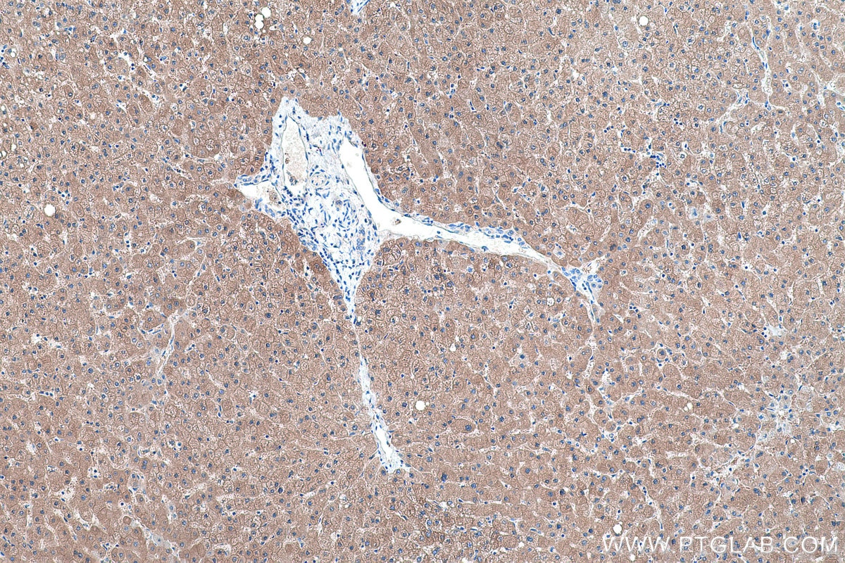 Immunohistochemical analysis of paraffin-embedded human liver tissue slide using KHC0398 (PKLR IHC Kit).