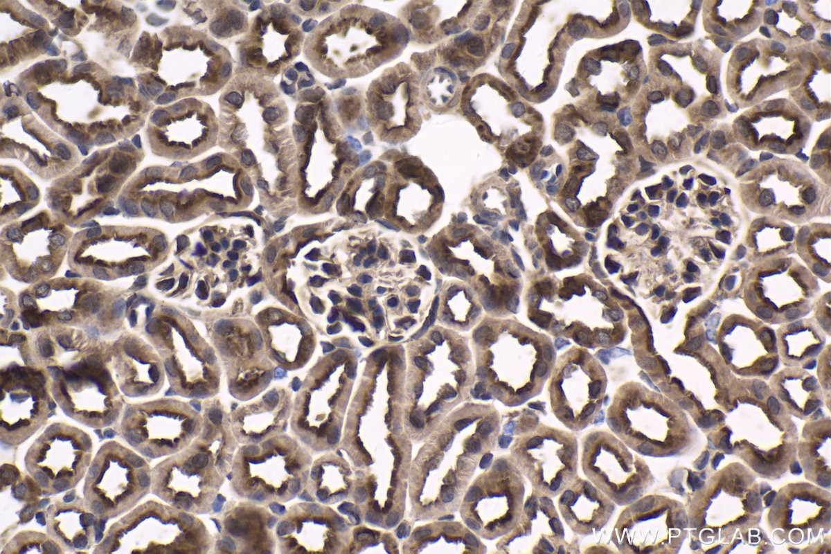 Immunohistochemical analysis of paraffin-embedded mouse kidney tissue slide using KHC1758 (PKN2 IHC Kit).