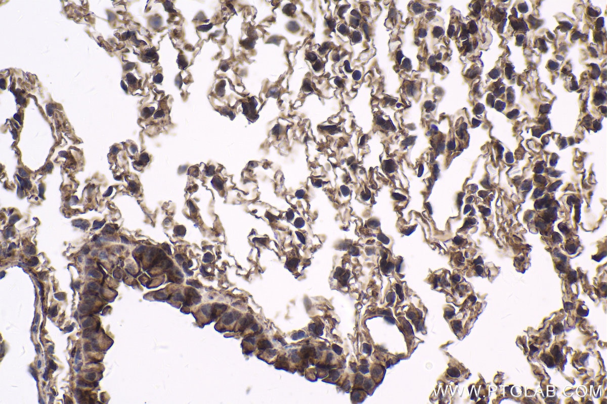 Immunohistochemical analysis of paraffin-embedded mouse lung tissue slide using KHC1758 (PKN2 IHC Kit).