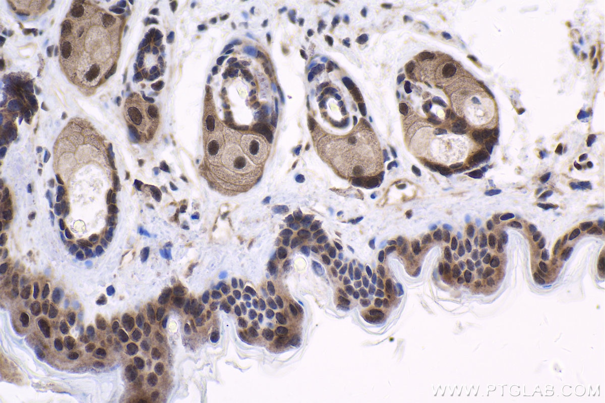 Immunohistochemical analysis of paraffin-embedded mouse skin tissue slide using KHC1758 (PKN2 IHC Kit).