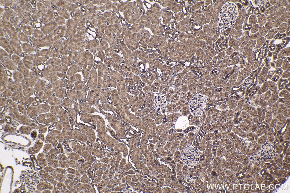 Immunohistochemical analysis of paraffin-embedded rat kidney tissue slide using KHC1758 (PKN2 IHC Kit).