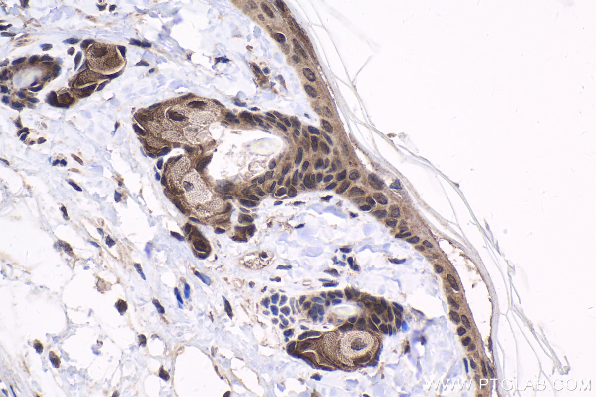 Immunohistochemical analysis of paraffin-embedded rat skin tissue slide using KHC1758 (PKN2 IHC Kit).