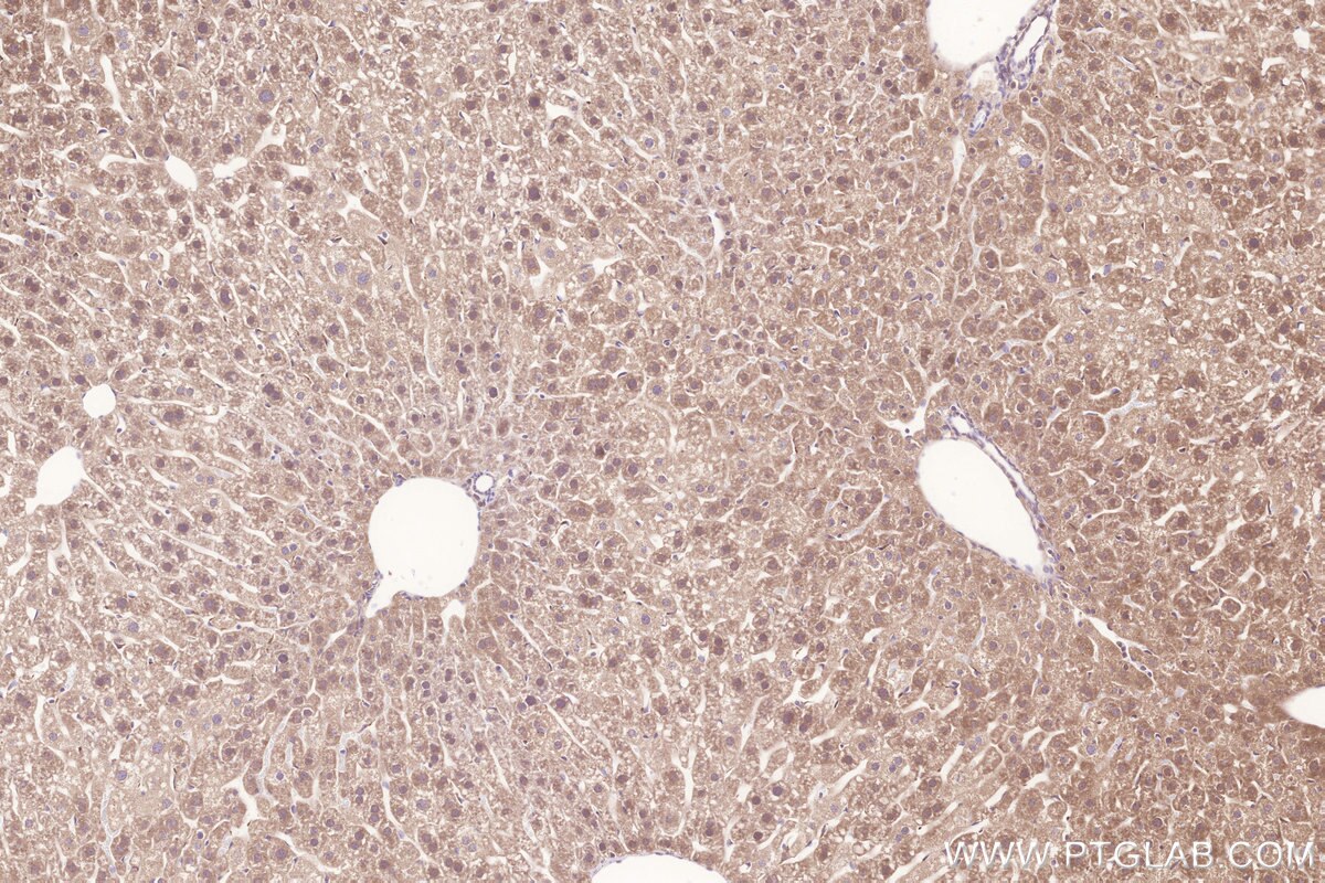 Immunohistochemical analysis of paraffin-embedded mouse liver tissue slide using KHC3293 (PLA2G15/LYPLA3 IHC Kit).