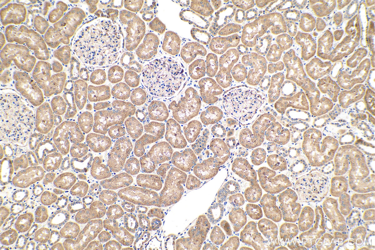 Immunohistochemical analysis of paraffin-embedded human kidney tissue slide using KHC0598 (Phospholipase C epsilon 1 IHC Kit).