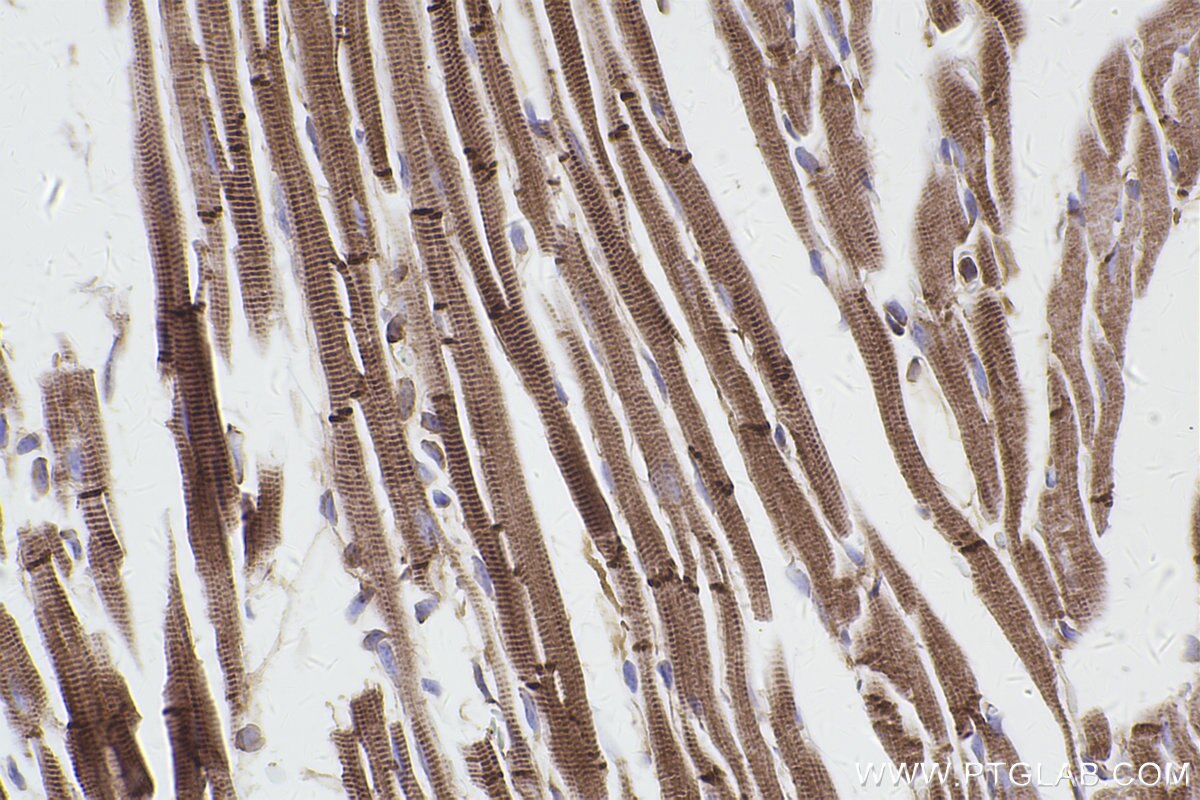 Immunohistochemical analysis of paraffin-embedded mouse heart tissue slide using KHC2482 (PLEC IHC Kit).