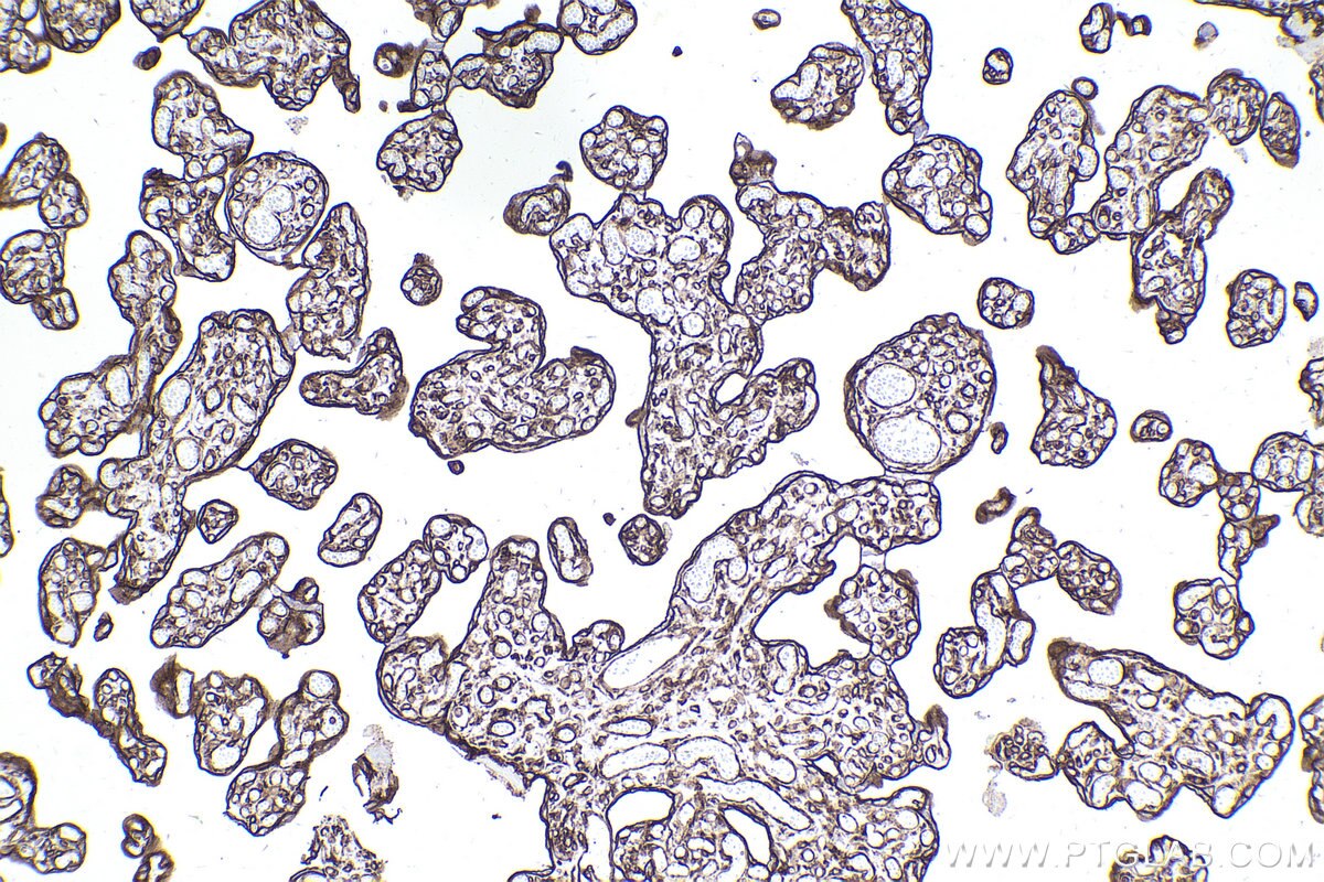 Immunohistochemical analysis of paraffin-embedded human placenta tissue slide using KHC2482 (PLEC IHC Kit).