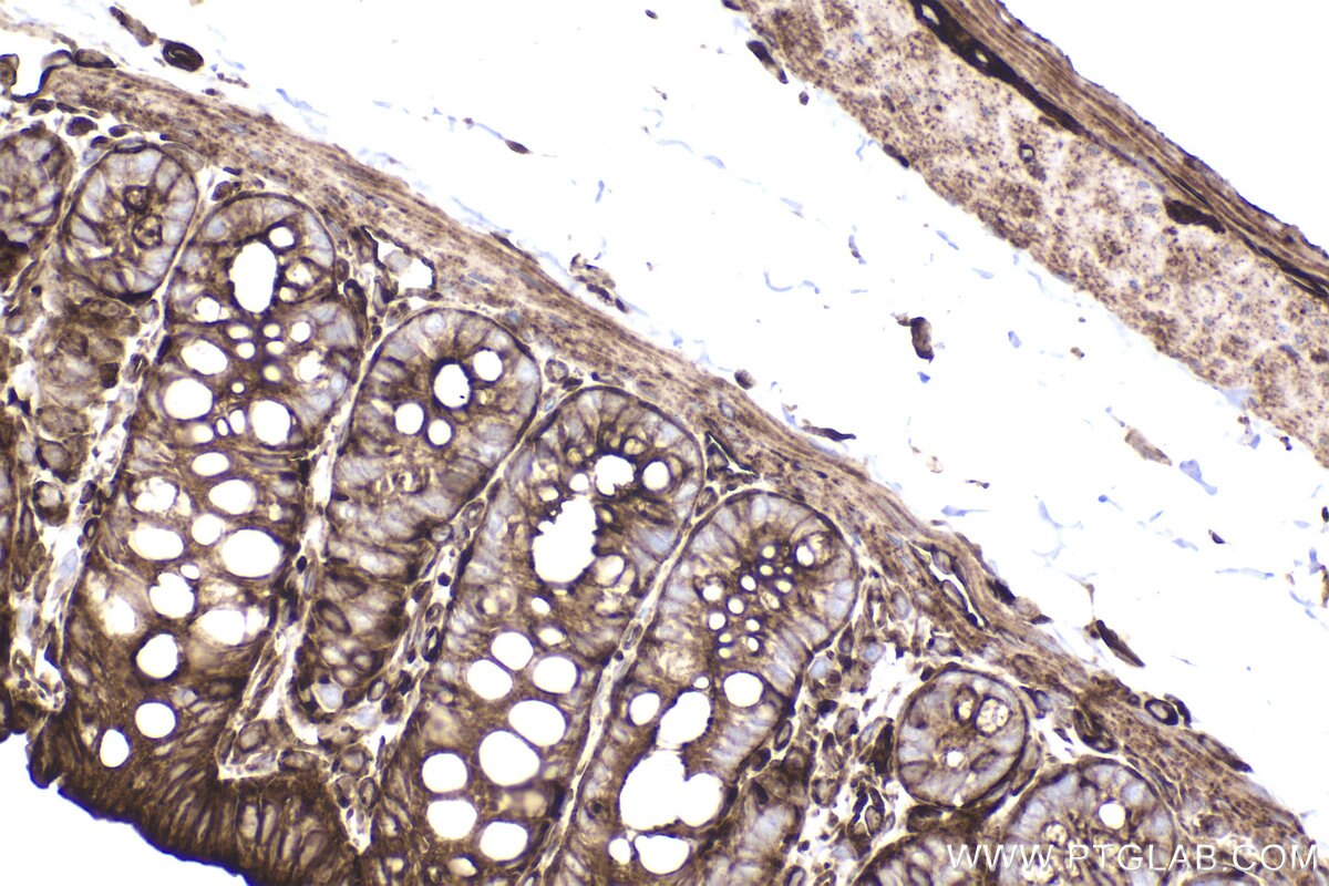 Immunohistochemical analysis of paraffin-embedded rat colon tissue slide using KHC2482 (PLEC IHC Kit).
