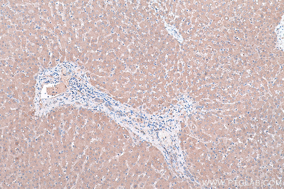 Immunohistochemical analysis of paraffin-embedded human liver tissue slide using KHC0445 (PLEK2 IHC Kit).