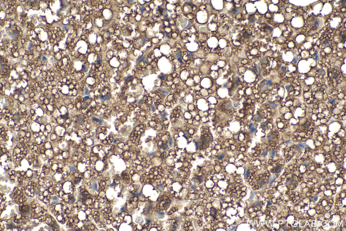 Immunohistochemical analysis of paraffin-embedded rat brown adipose tissue slide using KHC0228 (PLIN1 IHC Kit).