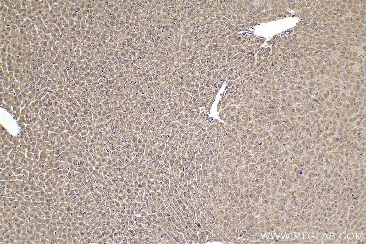 Immunohistochemical analysis of paraffin-embedded mouse liver tissue slide using KHC1624 (PLK1 IHC Kit).