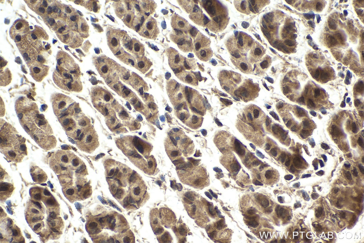 Immunohistochemical analysis of paraffin-embedded mouse stomach tissue slide using KHC1624 (PLK1 IHC Kit).
