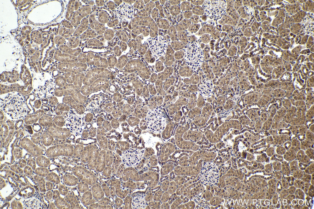 Immunohistochemical analysis of paraffin-embedded rat kidney tissue slide using KHC1624 (PLK1 IHC Kit).