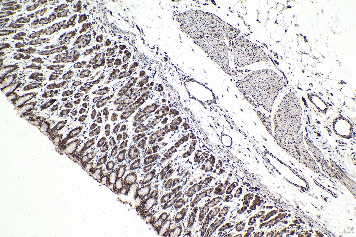 Immunohistochemical analysis of paraffin-embedded rat stomach tissue slide using KHC1624 (PLK1 IHC Kit).