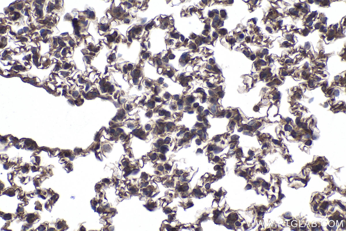Immunohistochemical analysis of paraffin-embedded mouse lung tissue slide using KHC1931 (PLK3 IHC Kit).