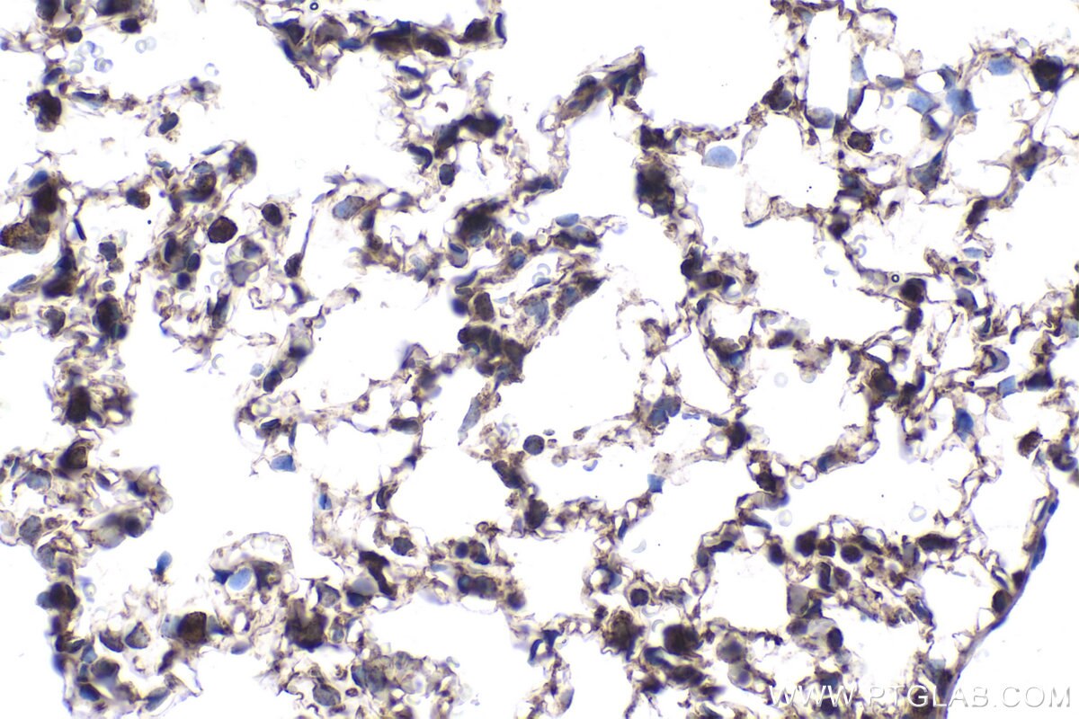 Immunohistochemical analysis of paraffin-embedded rat lung tissue slide using KHC1931 (PLK3 IHC Kit).