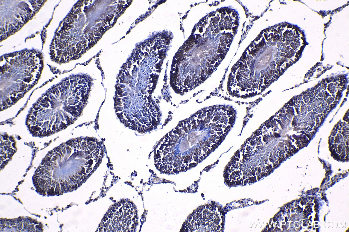 Immunohistochemical analysis of paraffin-embedded rat testis tissue slide using KHC1222 (PLK4 IHC Kit).