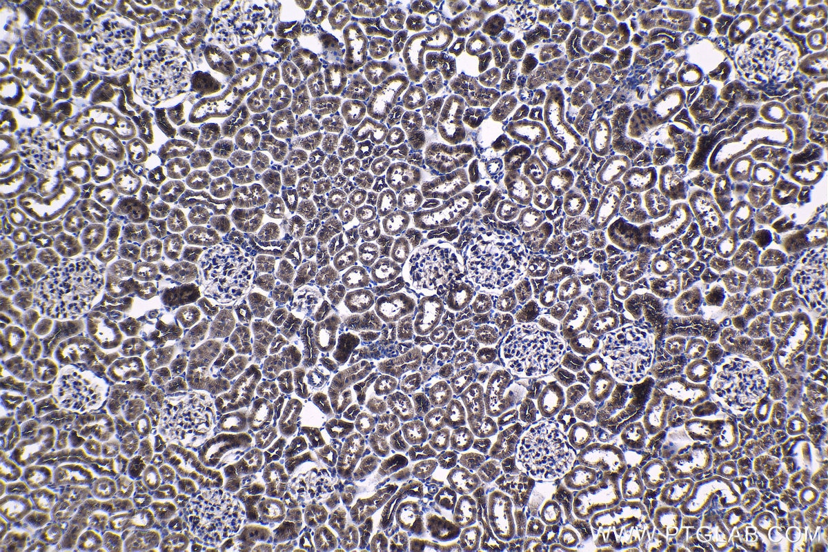 Immunohistochemical analysis of paraffin-embedded rat kidney tissue slide using KHC1222 (PLK4 IHC Kit).