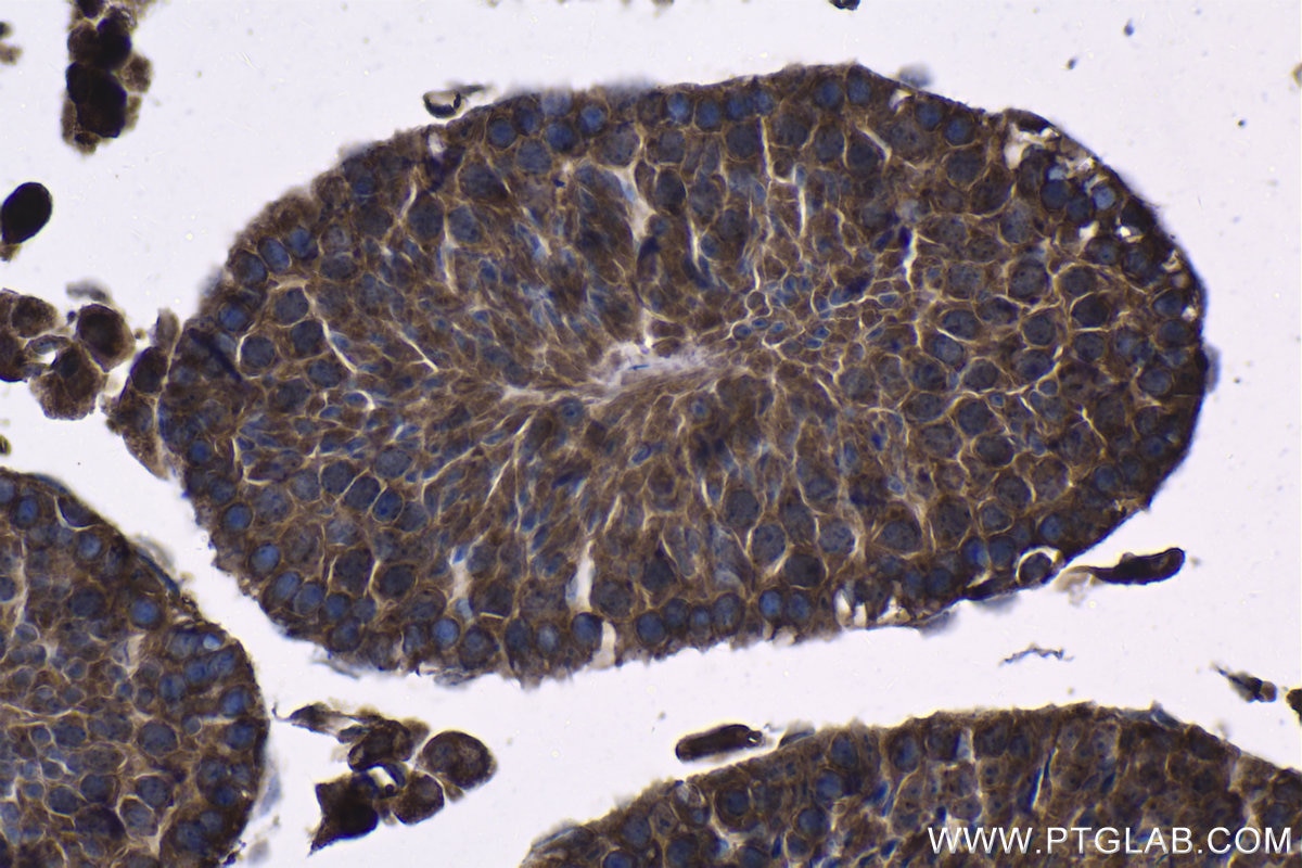 Immunohistochemical analysis of paraffin-embedded mouse testis tissue slide using KHC1222 (PLK4 IHC Kit).