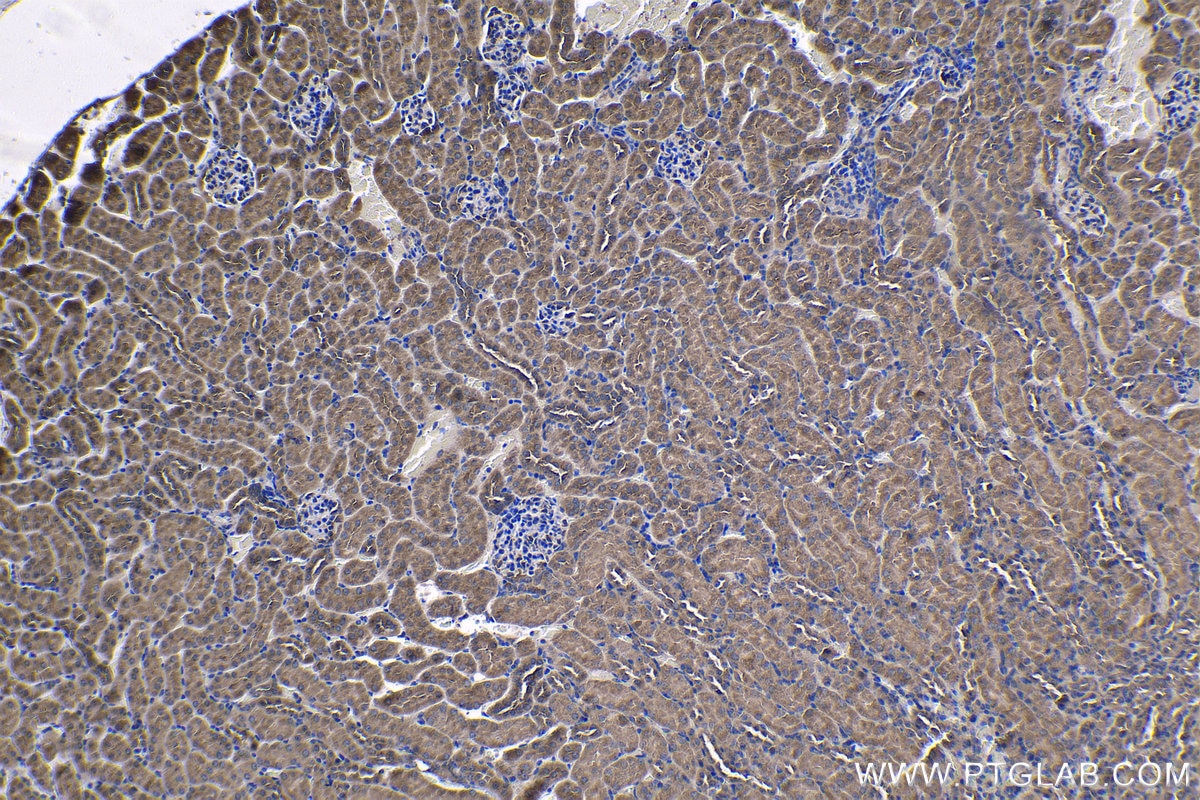 Immunohistochemical analysis of paraffin-embedded mouse kidney tissue slide using KHC1222 (PLK4 IHC Kit).