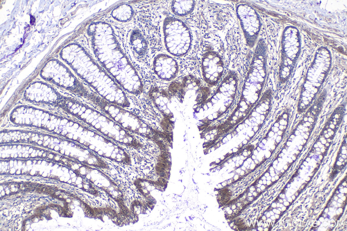 Immunohistochemical analysis of paraffin-embedded human colon tissue slide using KHC1222 (PLK4 IHC Kit).