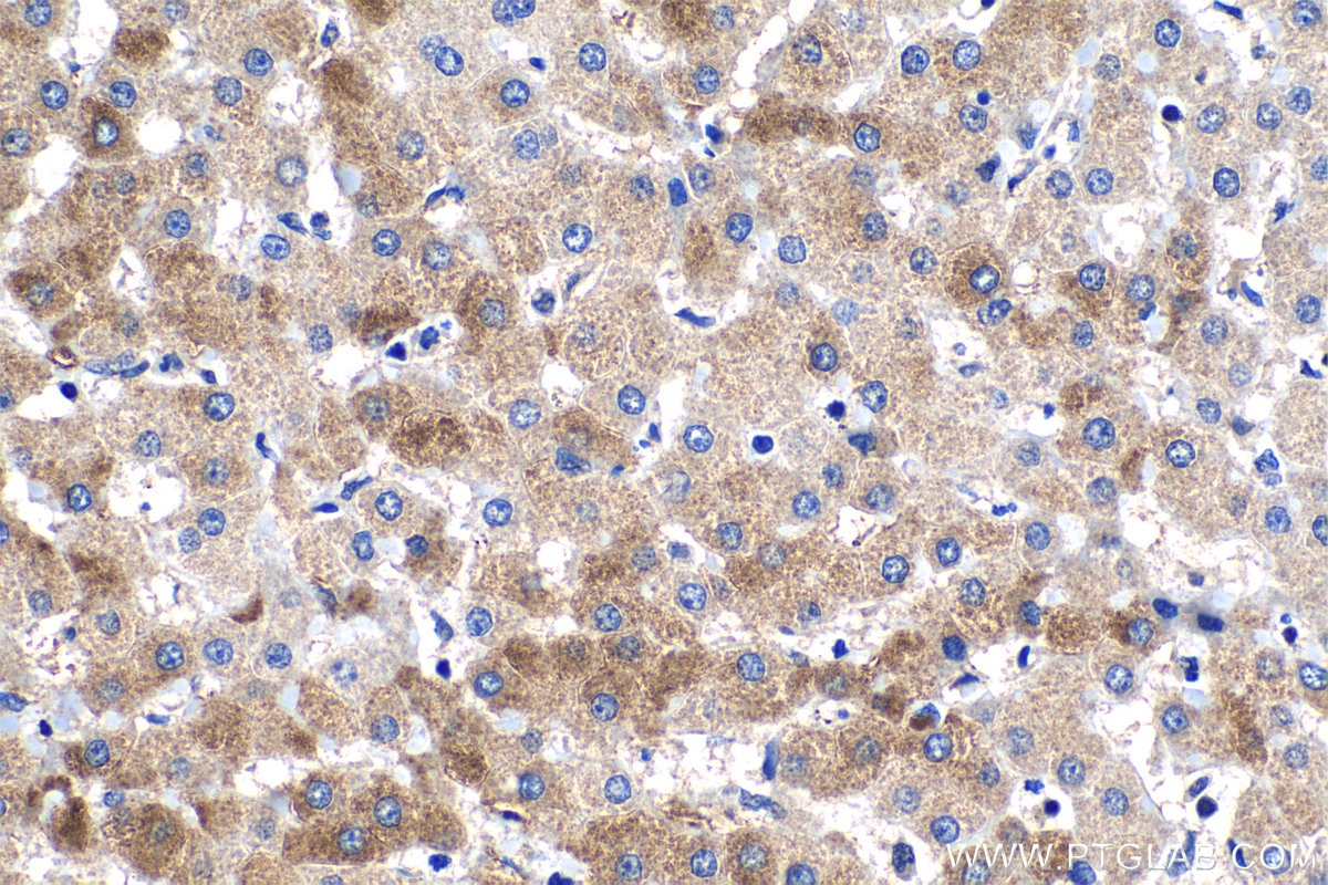 Immunohistochemical analysis of paraffin-embedded human liver tissue slide using KHC1240 (PLOD2 IHC Kit).