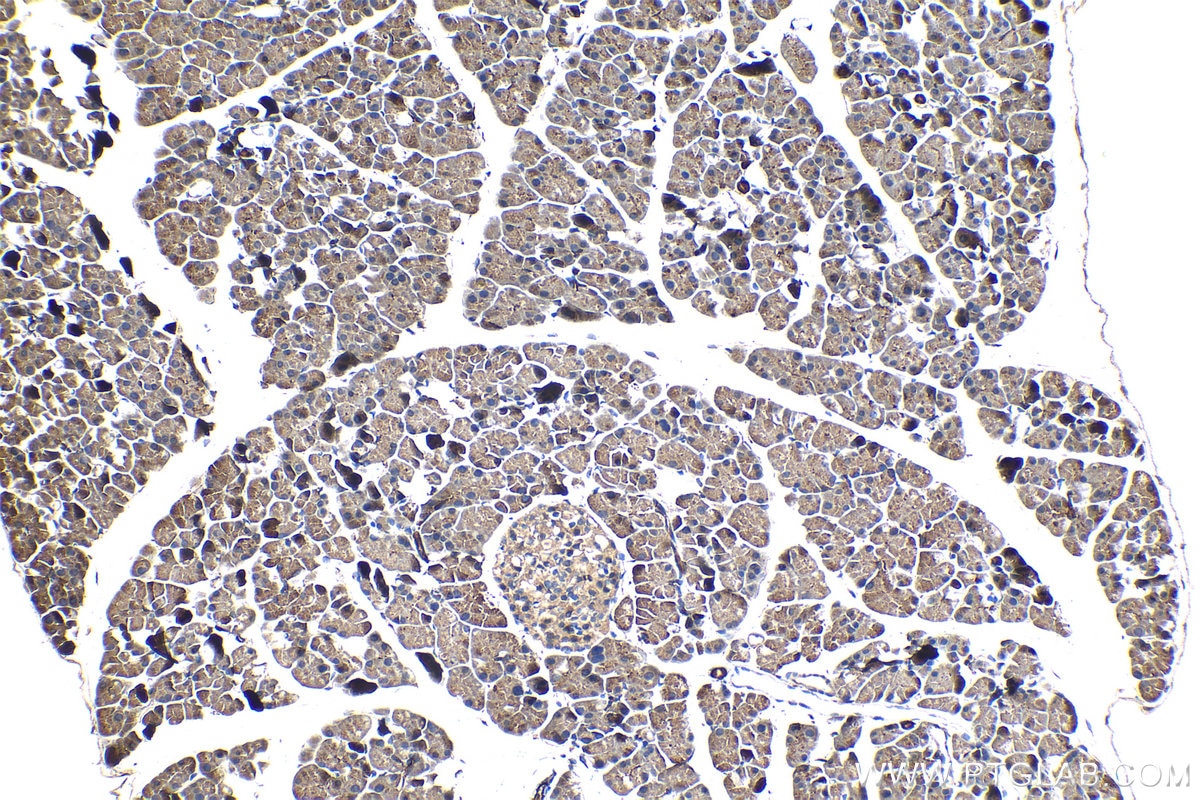 Immunohistochemical analysis of paraffin-embedded mouse pancreas tissue slide using KHC1240 (PLOD2 IHC Kit).