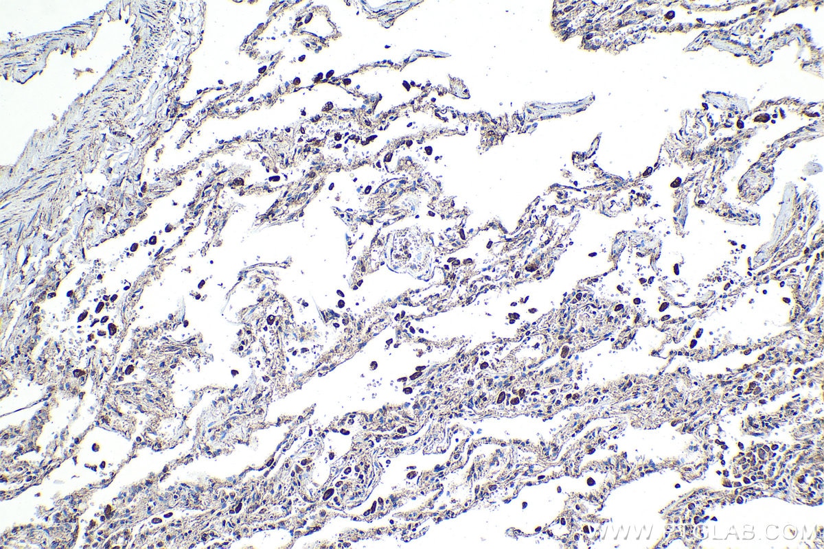 Immunohistochemical analysis of paraffin-embedded human lung tissue slide using KHC1436 (PLSCR1 IHC Kit).