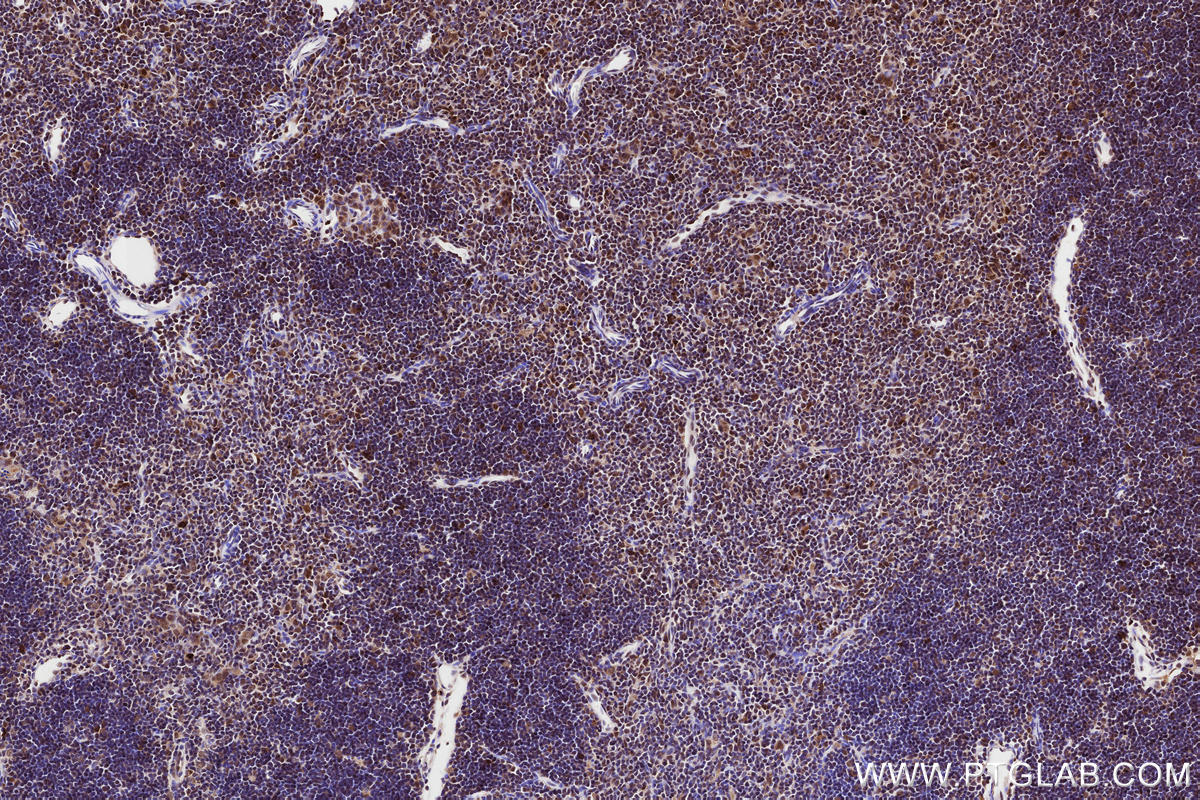 Immunohistochemical analysis of paraffin-embedded mouse thymus tissue slide using KHC3229 (PLTP IHC Kit).