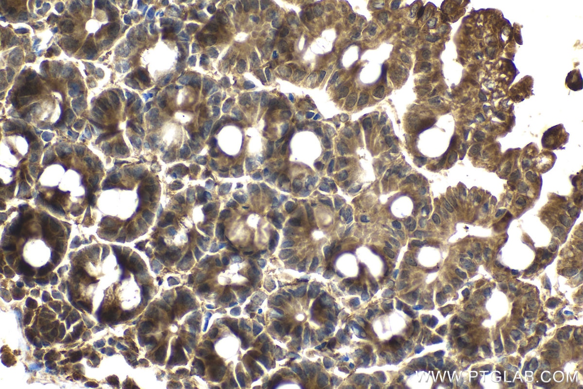 Immunohistochemical analysis of paraffin-embedded mouse small intestine tissue slide using KHC2072 (PLXNB1 IHC Kit).