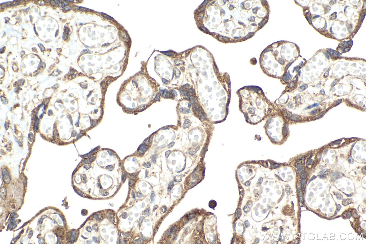 Immunohistochemical analysis of paraffin-embedded human placenta tissue slide using KHC2072 (PLXNB1 IHC Kit).