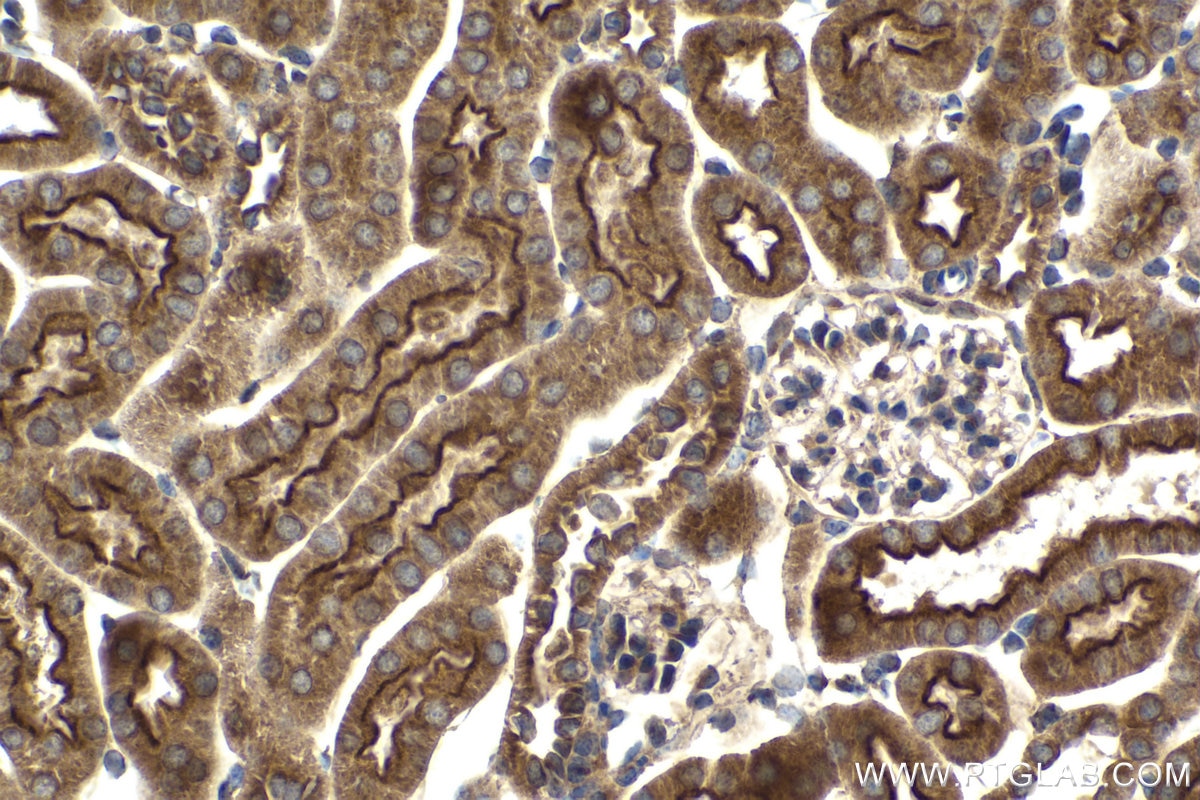 Immunohistochemical analysis of paraffin-embedded mouse kidney tissue slide using KHC2072 (PLXNB1 IHC Kit).