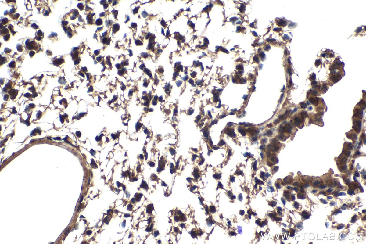 Immunohistochemical analysis of paraffin-embedded mouse lung tissue slide using KHC2072 (PLXNB1 IHC Kit).