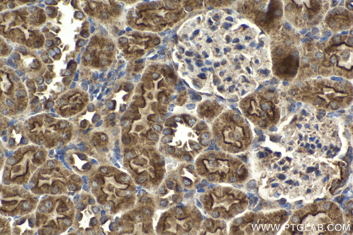 Immunohistochemical analysis of paraffin-embedded rat kidney tissue slide using KHC2072 (PLXNB1 IHC Kit).