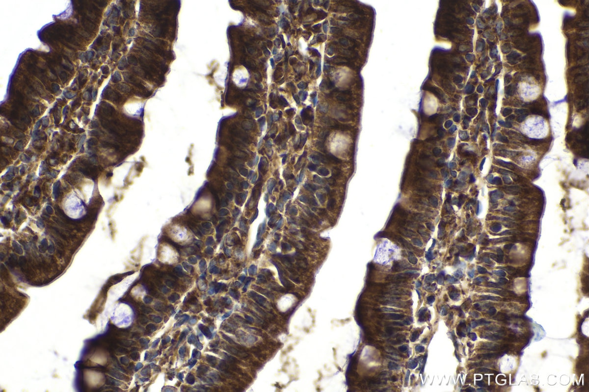 Immunohistochemical analysis of paraffin-embedded rat small intestine tissue slide using KHC2072 (PLXNB1 IHC Kit).