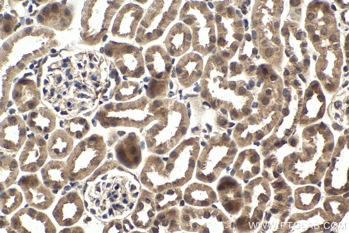 Immunohistochemical analysis of paraffin-embedded mouse kidney tissue slide using KHC1576 (PML IHC Kit).