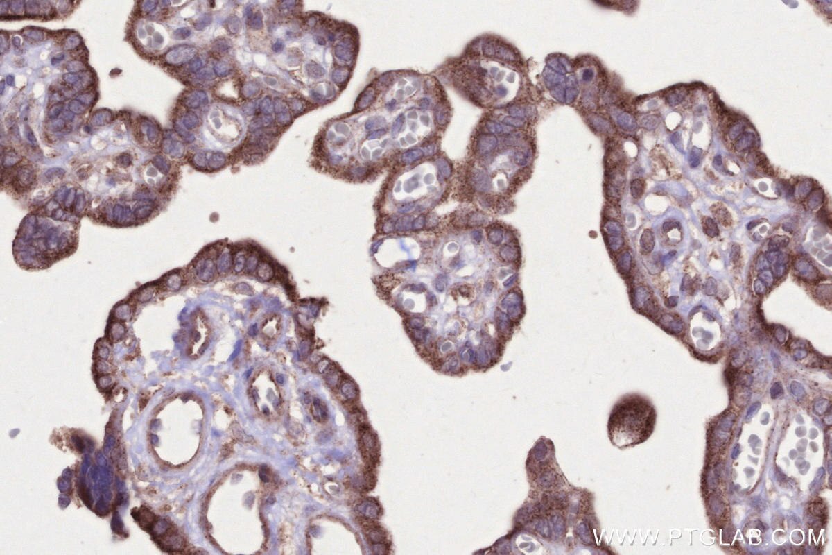 Immunohistochemical analysis of paraffin-embedded human placenta tissue slide using KHC2655 (PNPLA6 IHC Kit).