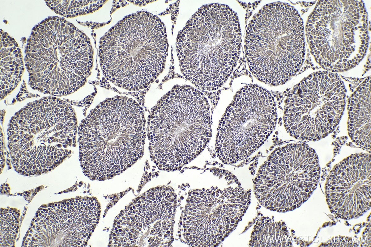 Immunohistochemical analysis of paraffin-embedded rat testis tissue slide using KHC1802 (POGZ IHC Kit).
