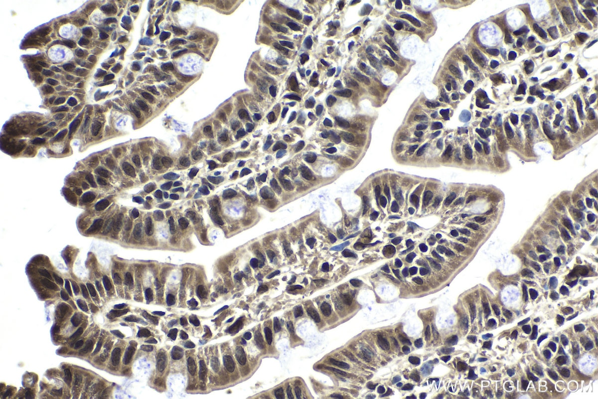 Immunohistochemical analysis of paraffin-embedded rat small intestine tissue slide using KHC1802 (POGZ IHC Kit).