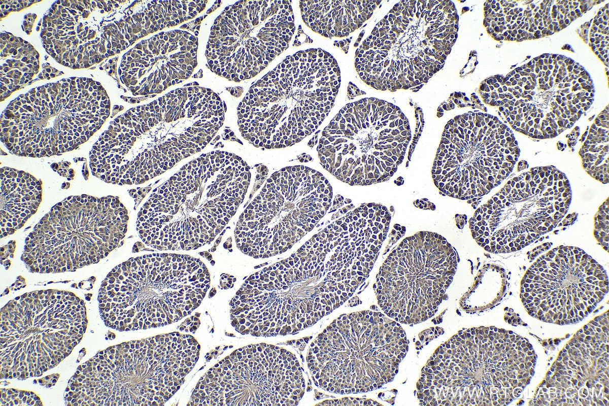 Immunohistochemical analysis of paraffin-embedded mouse testis tissue slide using KHC1802 (POGZ IHC Kit).