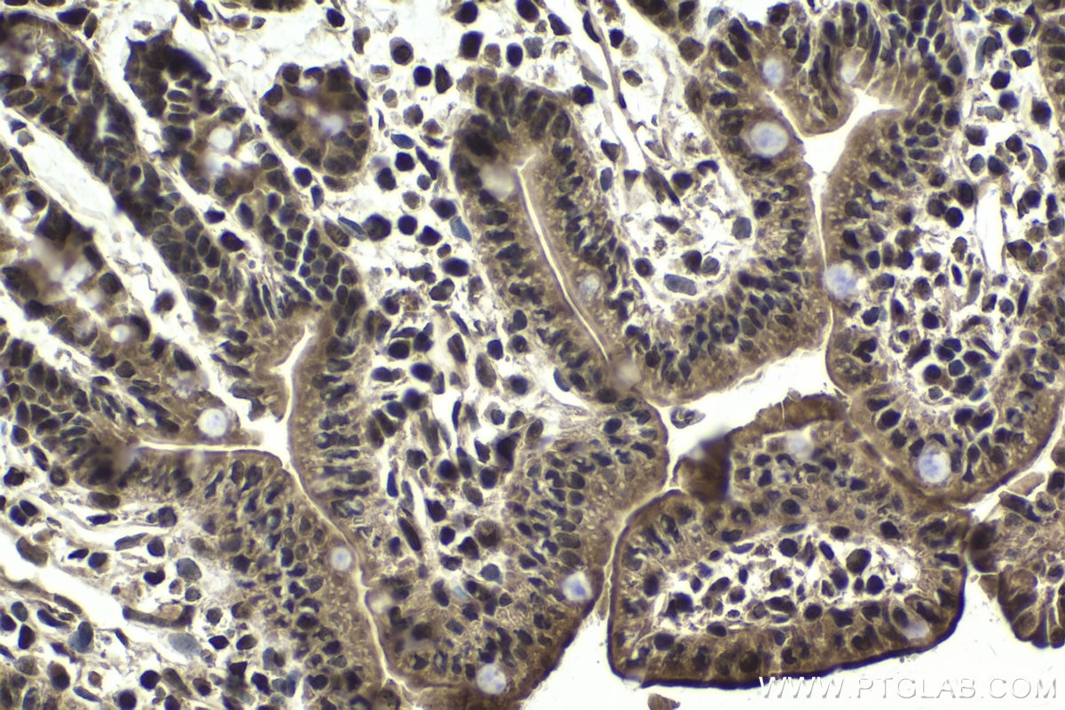 Immunohistochemical analysis of paraffin-embedded mouse small intestine tissue slide using KHC1802 (POGZ IHC Kit).
