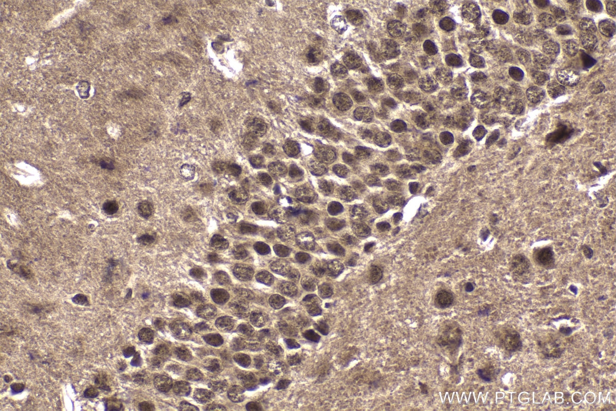 Immunohistochemical analysis of paraffin-embedded mouse brain tissue slide using KHC1802 (POGZ IHC Kit).