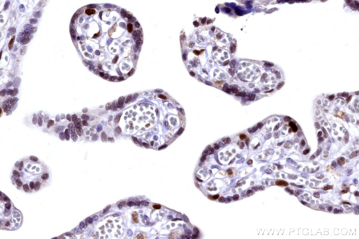 Immunohistochemical analysis of paraffin-embedded human placenta tissue slide using KHC3174 (POLA1 IHC Kit).