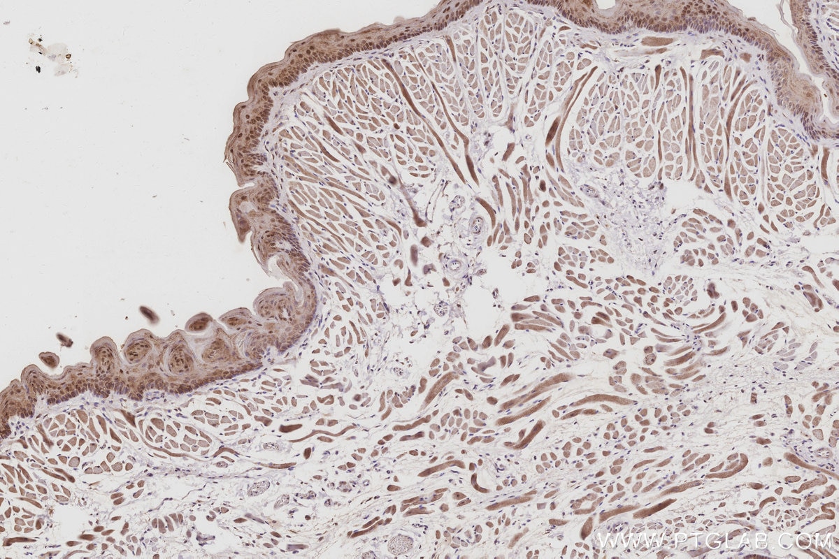 Immunohistochemical analysis of paraffin-embedded mouse tongue tissue slide using KHC3057 (POLDIP2 IHC Kit). Immunohistochemical analysis of paraffin-embedded mouse tongue tissue slide using KHC3057 (POLDIP2 IHC Kit).