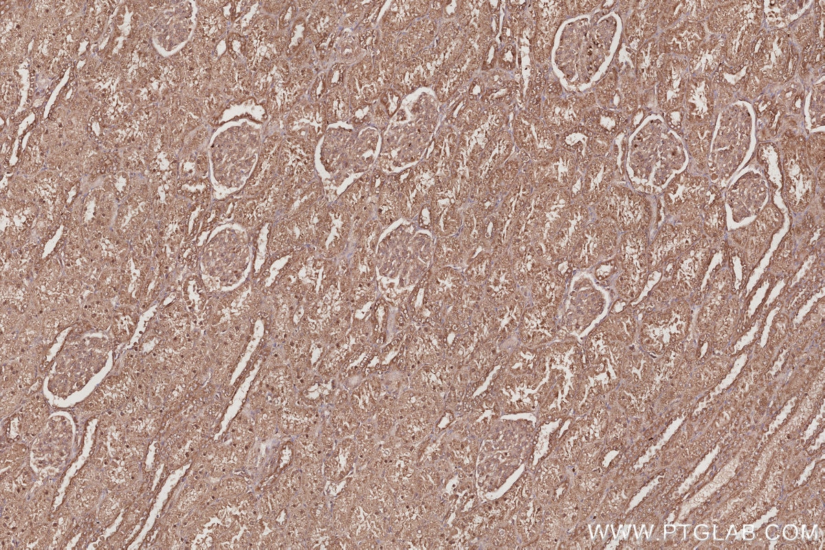Immunohistochemical analysis of paraffin-embedded human kidney tissue slide using KHC3057 (POLDIP2 IHC Kit). Immunohistochemical analysis of paraffin-embedded human kidney tissue slide using KHC3057 (POLDIP2 IHC Kit).