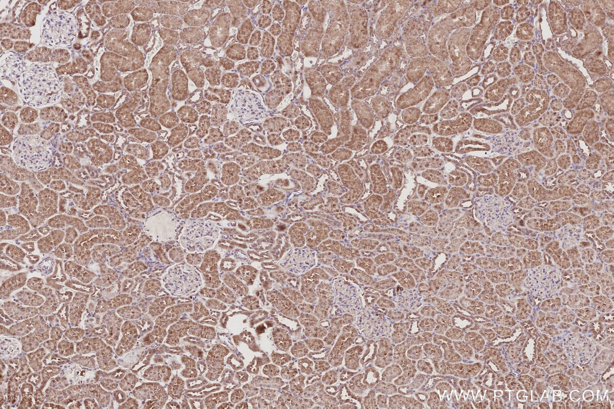 Immunohistochemical analysis of paraffin-embedded rat kidney tissue slide using KHC3057 (POLDIP2 IHC Kit). Immunohistochemical analysis of paraffin-embedded rat kidney tissue slide using KHC3057 (POLDIP2 IHC Kit).