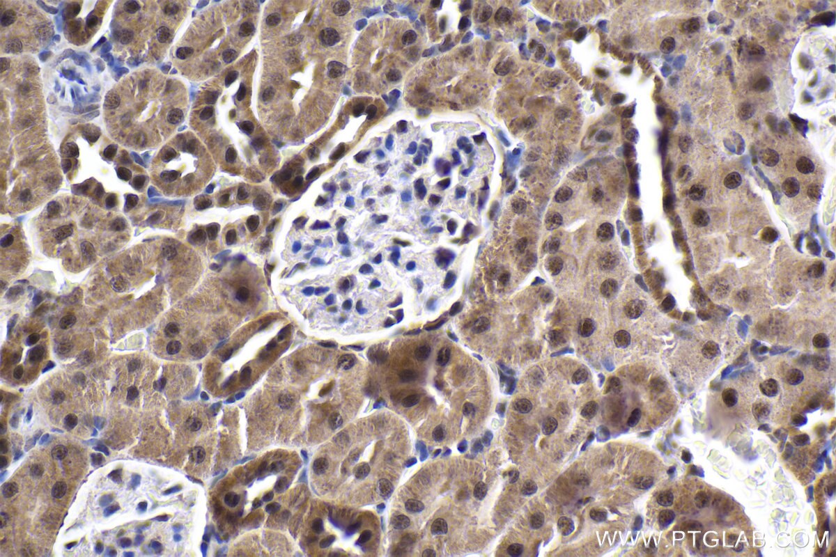 Immunohistochemical analysis of paraffin-embedded rat kidney tissue slide using KHC1908 (POLDIP3/SKAR IHC Kit).