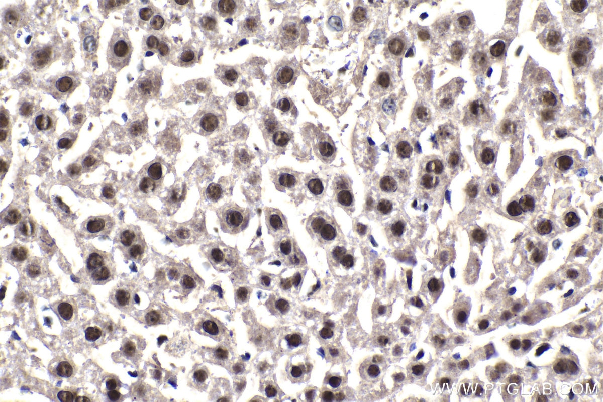 Immunohistochemical analysis of paraffin-embedded mouse liver tissue slide using KHC1918 (POLR1E IHC Kit).