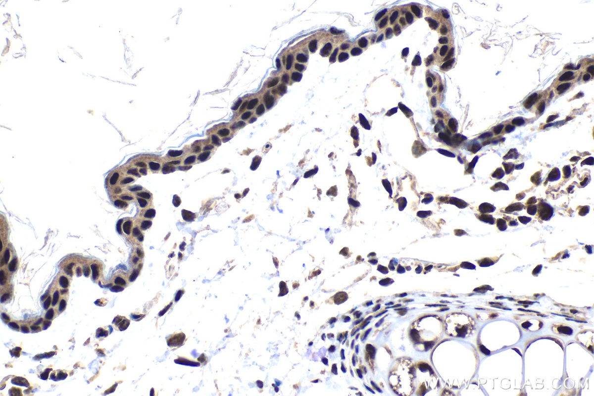 Immunohistochemical analysis of paraffin-embedded mouse skin tissue slide using KHC1544 (POLR2C IHC Kit).